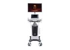 Model G76VET - Veterinary Trolley Color Doppler Ultrasound system