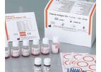 Febrile Antigens