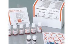 Febrile Antigens