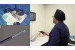 Introduction to Moray Medical Fluid-Driven Catheter System - Video