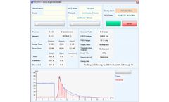 3d Acquisition Software With Cascade Scatter Correction
