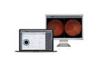 Zeiss - Data Management Scalable Ophthalmology Software