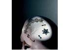 Precision-Surgical - Bioplate Cranial Fixation System
