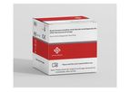 Novel Coronavirus (2019-nCoV) Nucleic Acid Diagnostic Kit (PCR-Fluorescence Probing)