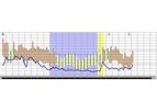 Meditech - Version CardioVisions - Holter Management Software
