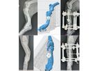 Steris - 3D Bone Prints