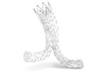 JOTEC - Model E-tegra - Abdominal Stent Graft