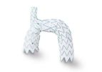 JOTEC - Model NEXUS - Aortic Arch Stent Graft System