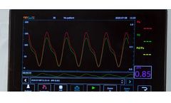 OpSens - Model OptoMonitor - Smart Integration Monitor