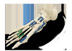 ARSENAL - Foot Plating System