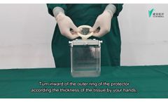 The operating steps of single use wound protector - Video