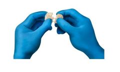 Biogennix - Morpheus and Agilon Moldable Bone Bone Grafting Products