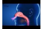 Atemtherapiegerät RC-Cornet PLUS NASAL - Wirkprinzip 3D-Animation - freie Nase ohne Medikamente - Video