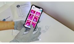 Ear Scope - Illuminated Ear Specula by Holland Healthcare - Video