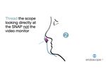 SNAP, Endoscope Guide Assembly Steps for Clinicians - Video