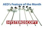 Feature of the Month: Hysteroscopy | Advanced Endoscopy Devices - Video
