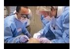 First Look: The Hahn™ Tapered Implant System - Video