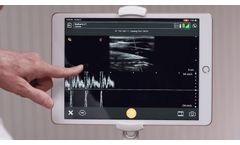 Clarius - Pulsed Wave Doppler