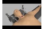 Set Up: Head & Neck Retractor System (Thyroid/Carotid) - Video