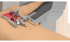 Thompson - Bolling Retractor System