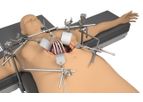 Thompson - Bariatric System