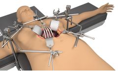 Thompson - Bariatric System