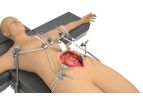 Thompson - General / Vascular System