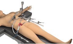 Thompson - Total Joint Frame