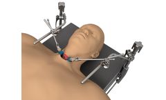 Thompson - Cervical System
