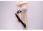 Securos - Model XGEN - Tibial Tuberosity Advancement (TTA) System
