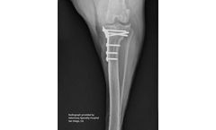 Securos - Tibial Plateau-Leveling Osteotomy (TPLO) System