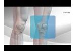 All-Inside ACL Reconstruction with Arthrex GraftLink - Video