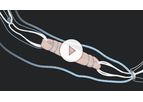 GraftLink - ACL Reconstruction Backup Fixation System