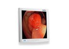 EndoVue - Model 19 Inch - Value Endoscopy Visualization