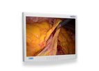 EndoVue - Model 21 Inch - Value Endoscopy Visualization