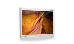 EndoVue - Model 21 Inch - Value Endoscopy Visualization