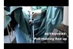 Laparoscopy Assistant - SurgiAssist Uterine Positioner - Video