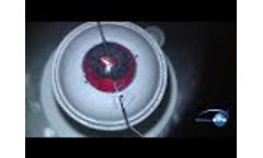 SimulEYE Iris Prosthesis IOL, CTR - Video