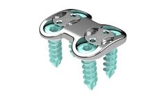 Origin - Anterior Cervical Plate