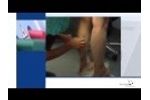 QuadroStarPRO940 - Training Video for Endovascular Laser Therapy (EVLT) from Asclepion - Video