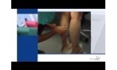 QuadroStarPRO940 - Training Video for Endovascular Laser Therapy (EVLT) from Asclepion - Video