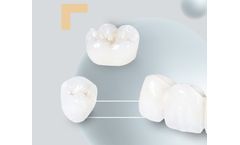Shinva - Bionic Aesthetic Zirconium