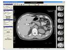 ClinicalExpress - Version DICOM - Film Acquisition Software
