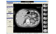 ClinicalExpress - Version DICOM - Film Acquisition Software