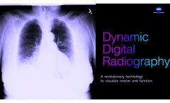 DDR Overview - Video