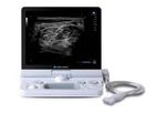 Sonimage - Model HS2 - Compact Superior Imaging System