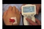 Stimpod Nerve Locating Technique - Video