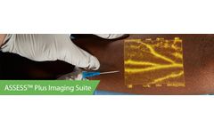 ASSESS Plus - Imaging Suite