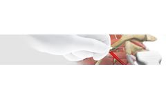 eZono - Needle Guidance Technology