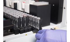 Assay Automation Support Services